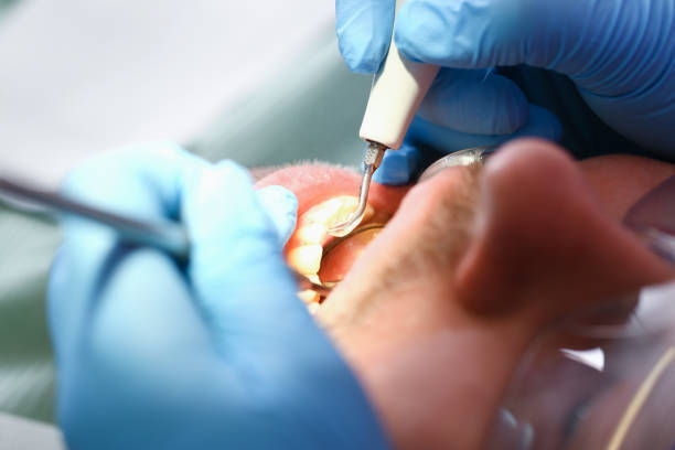 Best Pediatric Emergency Dentist in Rutherford, TN