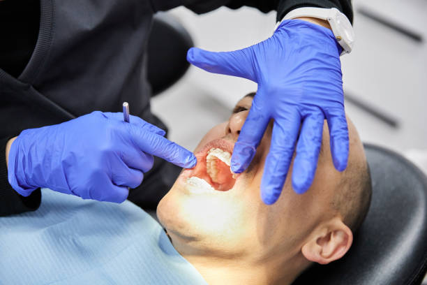 Best Emergency Dental Extractions in Rutherford, TN
