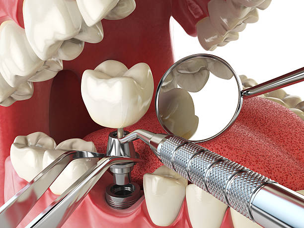 Best Weekend Emergency Dentist in Rutherford, TN